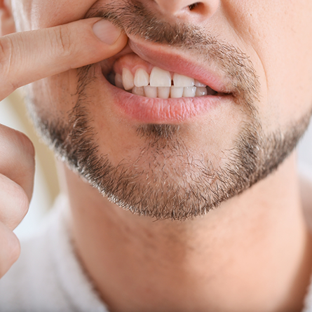 Close up of a man pointing to his gums after gum disease treatment in Portland